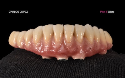 Dental Alchemy