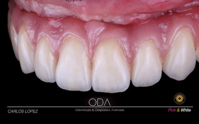 Dental Alchemy