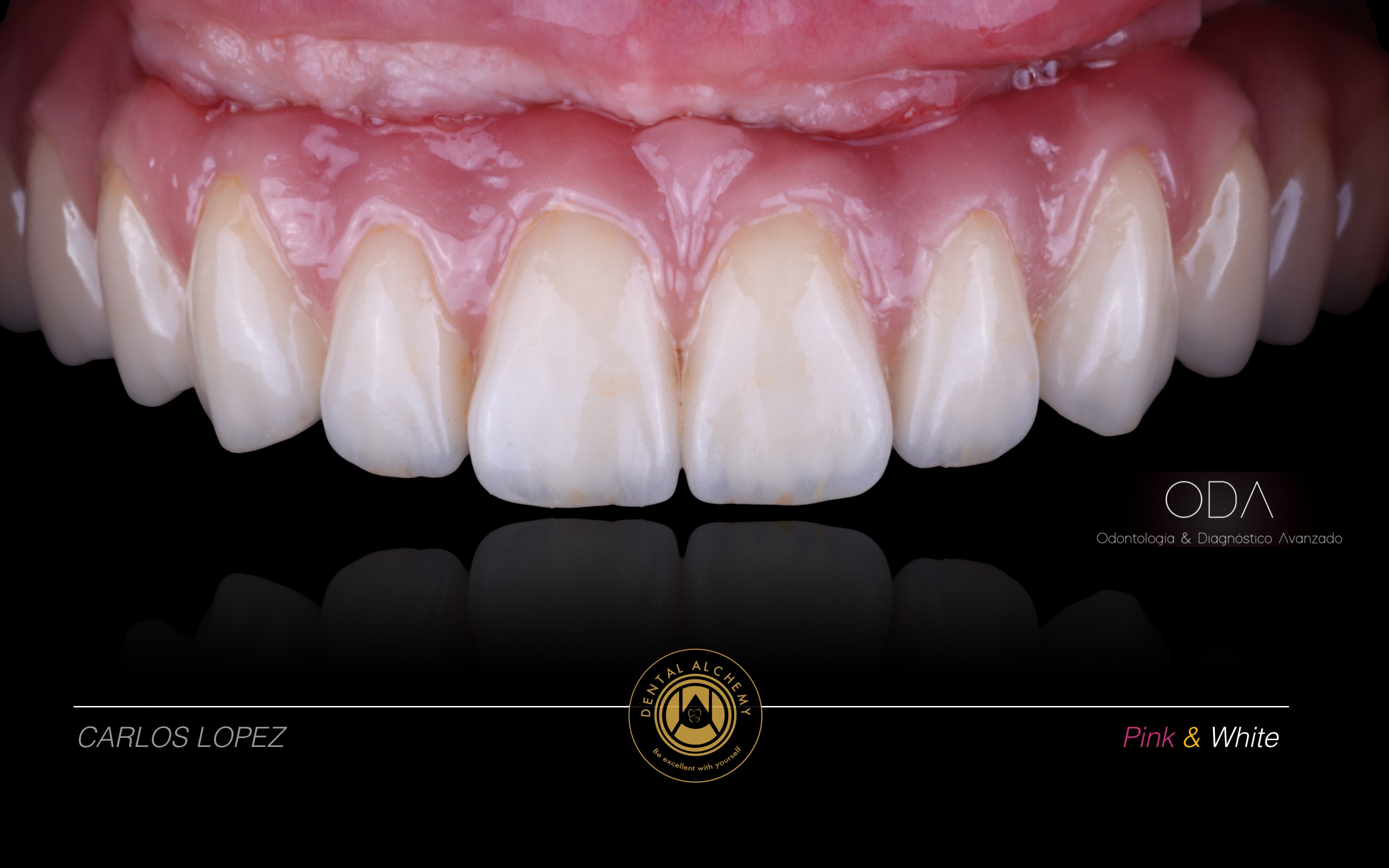 Dental Alchemy