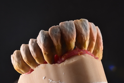 Dental Alchemy