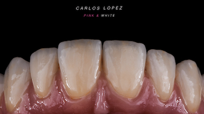 Dental Alchemy