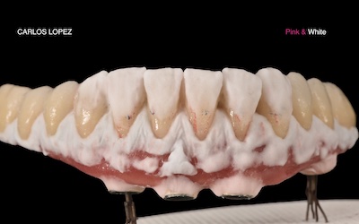 Dental Alchemy